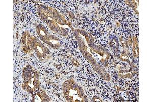 IHC analysis of RPL10 using anti-RPL10 antibody (ABIN7601177). (RPL10 antibody  (AA 3-214))