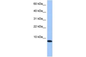 Western Blotting (WB) image for anti-Transition Protein 1 (During Histone To Protamine Replacement) (TNP1) antibody (ABIN2463577)