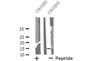 MGST2 antibody  (Internal Region)