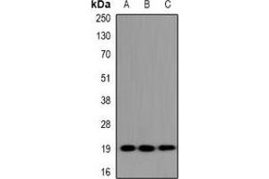 Western blot analysis of UBE2G1 expression in HeLa (A), NIH3T3 (B), H9C2 (C) whole cell lysates. (UBE2G1 antibody)