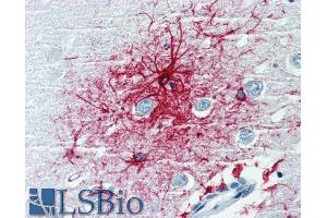 Immunohistochemistry staining of human brain cortex (paraffin-embedded sections) with anti-GFAP (clone Commercially tested by LifeSpan BioSciences (GFAP antibody)