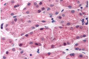 Human Kidney (formalin-fixed, paraffin-embedded) stained with REN antibody ABIN292449 at 2. (Renin antibody)