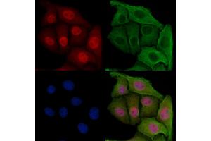 ABIN6257316 and ABIN6275218 staining Hela cells by IF/ICC.