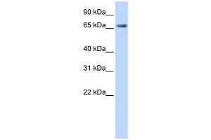 WB Suggested Anti-DLG3 Antibody Titration:  0. (DLG3 antibody  (N-Term))