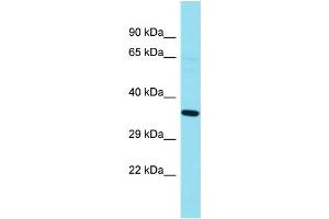Western Blotting (WB) image for anti-G Kinase Anchoring Protein 1 (GKAP1) (N-Term) antibody (ABIN2791554) (GKAP1 antibody  (N-Term))