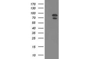 Western Blotting (WB) image for anti-Mitogen-Activated Protein Kinase 12 (MAPK12) antibody (ABIN1499307) (MAPK12 antibody)