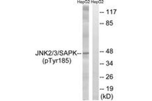 Western blot analysis of extracts from HepG2 cells treated with nocodazole 1ug/ml 16h, using SAPK/JNK (Phospho-Tyr185) Antibody. (SAPK, JNK (AA 151-200), (pTyr185) antibody)