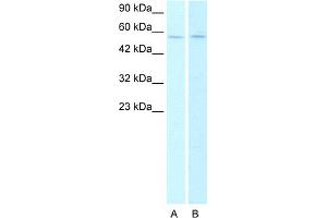Host:  Rabbit   Target Name:  CHRNA2 Lane A: HepG2 cell lysates Lane B: Raji cell lysates   Antibody Dilution:   0. (CHRNA2 antibody  (N-Term))