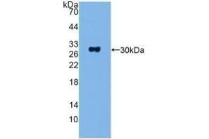 Detection of Recombinant ADCY1, Human using Polyclonal Antibody to Adenylate Cyclase 1, Brain (ADCY1) (ADCY1 antibody  (AA 835-1061))
