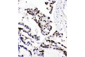 Immunohistochemistry (IHC) image for anti-Minichromosome Maintenance Complex Component 6 (MCM6) (AA 589-605), (Middle Region) antibody (ABIN3044159)