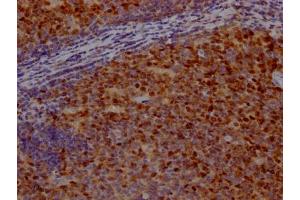 IHC image of ABIN7127831 diluted at 1:100 and staining in paraffin-embedded human tonsil tissue performed on a Leica BondTM system. (Recombinant Survivin antibody)