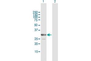 Western Blot analysis of ARMC10 expression in transfected 293T cell line by ARMC10 MaxPab polyclonal antibody. (ARMC10 antibody  (AA 1-308))