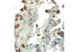 Immunohistochemical staining of human lung cells with EZH1 polyclonal antibody  at 5 ug/mL. (EZH1 antibody  (N-Term))