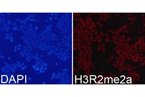 Immunofluorescence analysis of 293T cells using Asymmetric DiMethyl-Histone H3-R2 antibody. (Histone 3 antibody  (H3R2me2))