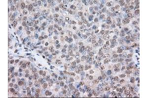 Immunohistochemical staining of paraffin-embedded Human colon tissue using anti-TACC3 mouse monoclonal antibody.