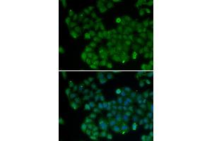 Immunofluorescence analysis of U20S cell using DNMT3L antibody. (DNMT3L antibody)