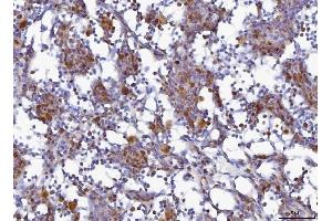IHC analysis of MCM6 using anti-MCM6 antibody (ABIN7600035).