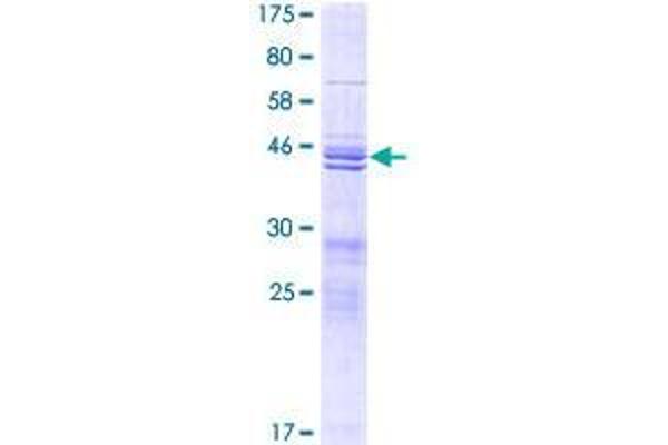 TIFA Protein (AA 1-184) (GST tag)