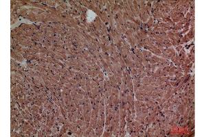 Immunohistochemistry (IHC) analysis of paraffin-embedded Mouse Heart, antibody was diluted at 1:100. (P2RX3 antibody  (Internal Region))
