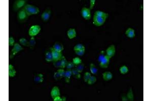 Immunofluorescent analysis of HepG2 cells using ABIN7153179 at dilution of 1:100 and Alexa Fluor 488-congugated AffiniPure Goat Anti-Rabbit IgG(H+L) (FZD1 antibody  (AA 125-225))
