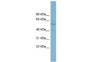 WB Suggested Anti-SUSD4 Antibody Titration:  0. (SUSD4 antibody  (Middle Region))