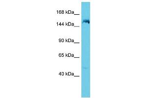 Host: Rabbit Target Name: ANKRD36B Sample Type: 721_B Whole Cell lysates Antibody Dilution: 1. (ANKRD36B antibody  (C-Term))