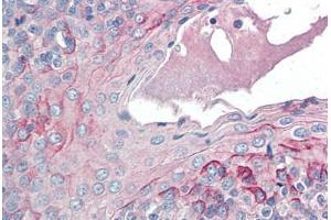 Human Tonsil (formalin-fixed, paraffin-embedded) stained with CCR6 antibody ABIN337207 at 5 ug/ml followed by biotinylated anti-goat IgG secondary antibody ABIN481715, alkaline phosphatase-streptavidin and chromogen. (CCR6 antibody  (AA 18-46))
