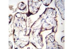 Immunohistochemistry (IHC) image for anti-Transforming Growth Factor, beta Receptor II (70/80kDa) (TGFBR2) (AA 13-40) antibody (ABIN3029224)