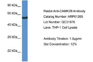 Western Blotting (WB) image for anti-Calcium/calmodulin-Dependent Protein Kinase II beta (CAMK2B) (Middle Region) antibody (ABIN786379) (CAMK2B antibody  (Middle Region))