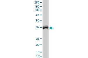 BLVRA monoclonal antibody (M01), clone 4G4-2B6. (Biliverdin Reductase antibody  (AA 1-296))