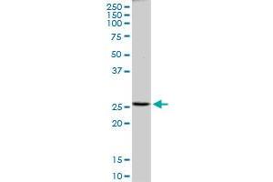 PRDX4 monoclonal antibody (M01), clone 2C12. (Peroxiredoxin 4 antibody  (AA 51-150))