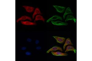 ABIN6261614 and ABIN6273044 staining Hela cells by IF/ICC.