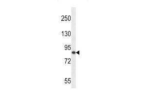 Western blot analysis in MDA-MB453 cell line lysates (35ug/lane). (OTUD7B antibody  (C-Term))