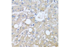 Immunohistochemistry of paraffin-embedded human liver injury using TUBGCP3 antibody.