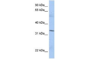 WB Suggested Anti-MRPL15 Antibody Titration:  0. (MRPL15 antibody  (N-Term))