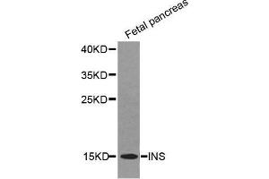 Western Blotting (WB) image for anti-Insulin (INS) (AA 1-110) antibody (ABIN6219279) (Insulin antibody  (AA 1-110))