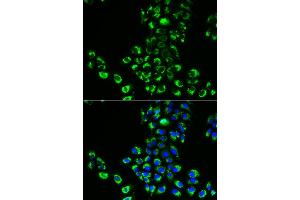 Immunofluorescence analysis of A549 cells using EIF5B antibody.
