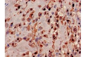 Immunohistochemistry of paraffin-embedded human placenta tissue using ABIN7142365 at dilution of 1:100 (MRPL19 antibody  (AA 1-292))