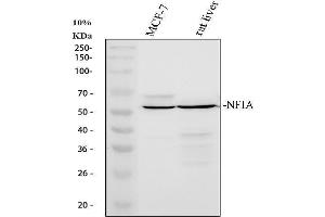 Western blot analysis of NFIA using anti-NFIA antibody (ABIN4886680). (NFIA antibody  (Middle Region))