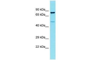 Host: Rabbit Target Name: CCDC121 Sample Type: OVCAR-3 Whole Cell lysates Antibody Dilution: 1. (CCDC121 antibody  (Middle Region))