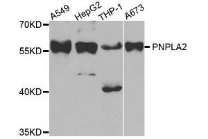 Western blot analysis of extracts of various cell lines, using PNPLA2 antibody. (PNPLA2 antibody  (AA 265-504))