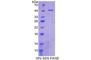 SDS-PAGE (SDS) image for CD97 (CD97) (AA 191-304) protein (His tag,GST tag) (ABIN2122654)