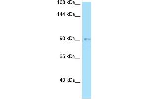 WB Suggested Anti-OPA1 Antibody Titration: 1. (OPA1 antibody  (N-Term))
