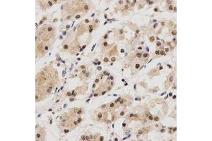 Immunohistochemistry of paraffin-embedded human stomach using KPNA4 Antibody. (KPNA4 antibody  (AA 1-240))