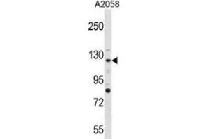 Western blot analysis in A2058 cell line lysates (35ug/lane) using PTPRN2  Antibody . (PTPRN2 antibody  (N-Term))