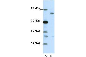 WB Suggested Anti-LZTR1 Antibody Titration:  2. (LZTR1 antibody  (C-Term))