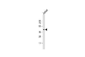 Anti-PIM1 Antibody  at 1:1000 dilution + Jurkat whole cell lysate Lysates/proteins at 20 μg per lane. (PIM1 antibody  (C-Term))