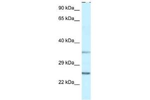 Western Blot showing PPP1R2 antibody used at a concentration of 1 ug/ml against THP-1 Cell Lysate (PPP1R2 antibody  (N-Term))