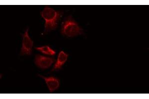 ABIN6269242 staining LOVO by IF/ICC. (CASR antibody  (C-Term))