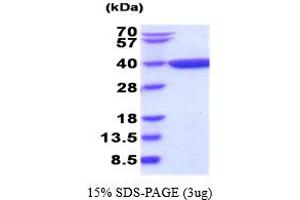SDS-PAGE (SDS) image for Dihydrodiol Dehydrogenase (DDH) (AA 1-323) (Active) protein (ABIN6387732) (AKR1C1 Protein (AA 1-323))